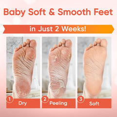 Bottes jetables CÉLOR pour peeling des pieds à domicile, confort et simplicité.