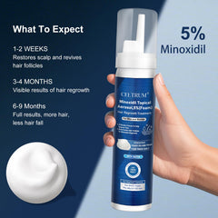 Celtrum Minoxidil Foam – application sur cuir chevelu, routine deux fois par jour.