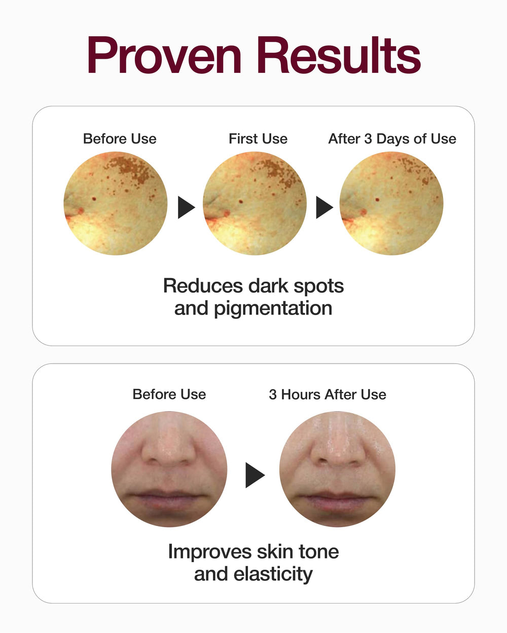 CENTELLian 24 Expert Madeca Mela Capture Ampoule Max, texture lactée légère offrant hydratation durable