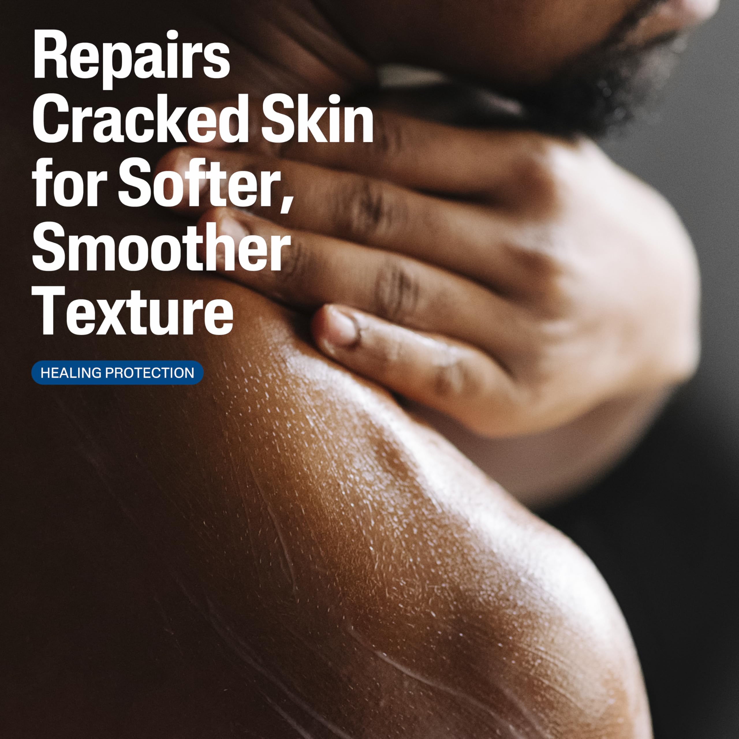 Barriere cutanee renforcee pour peau seche et irritee
