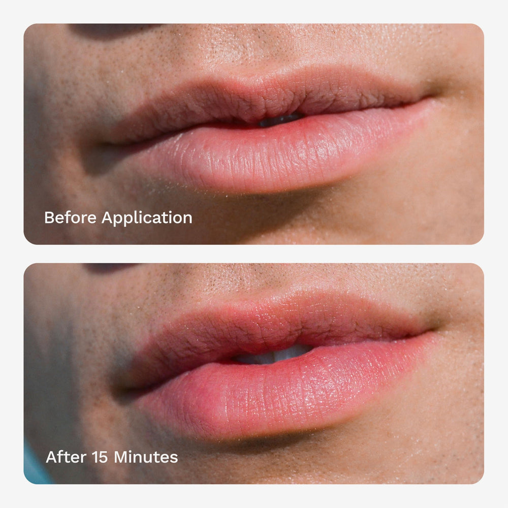 Applicateur du Lip Plumper Chaddy prêt à l’emploi pour une application précise
