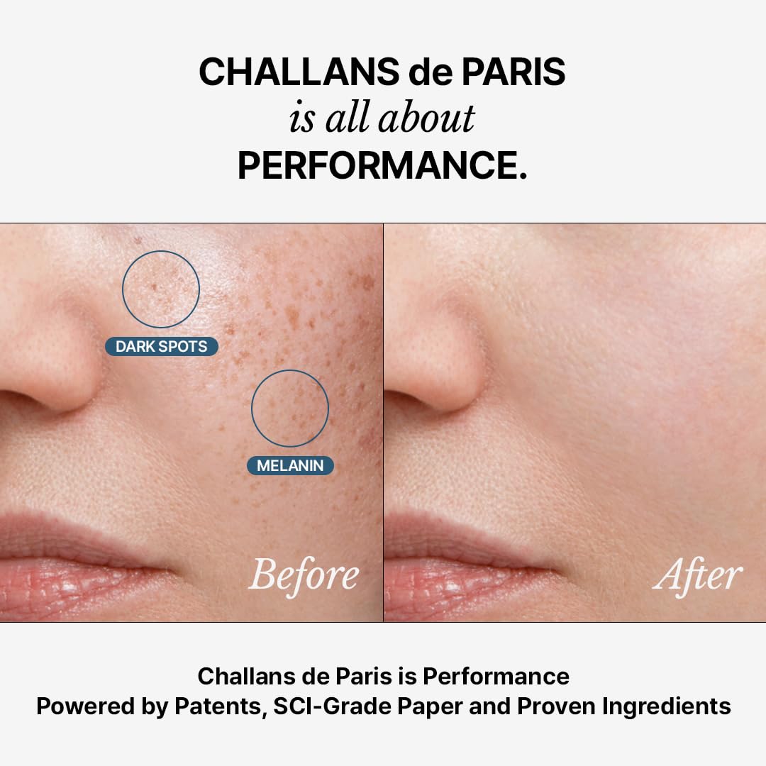 CHALLANS de PARIS Ampoule Albarosa: application matin et soir sur visage.