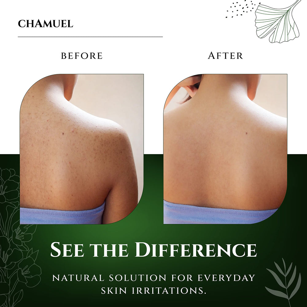 Chamuel Tea Tree Body Wash senteur menthe-eucalyptus pour revitalisation
