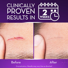 Cicatricure Gel Avancé pour cicatrices chirurgicales, amélioration potentielle avec utilisation régulière.