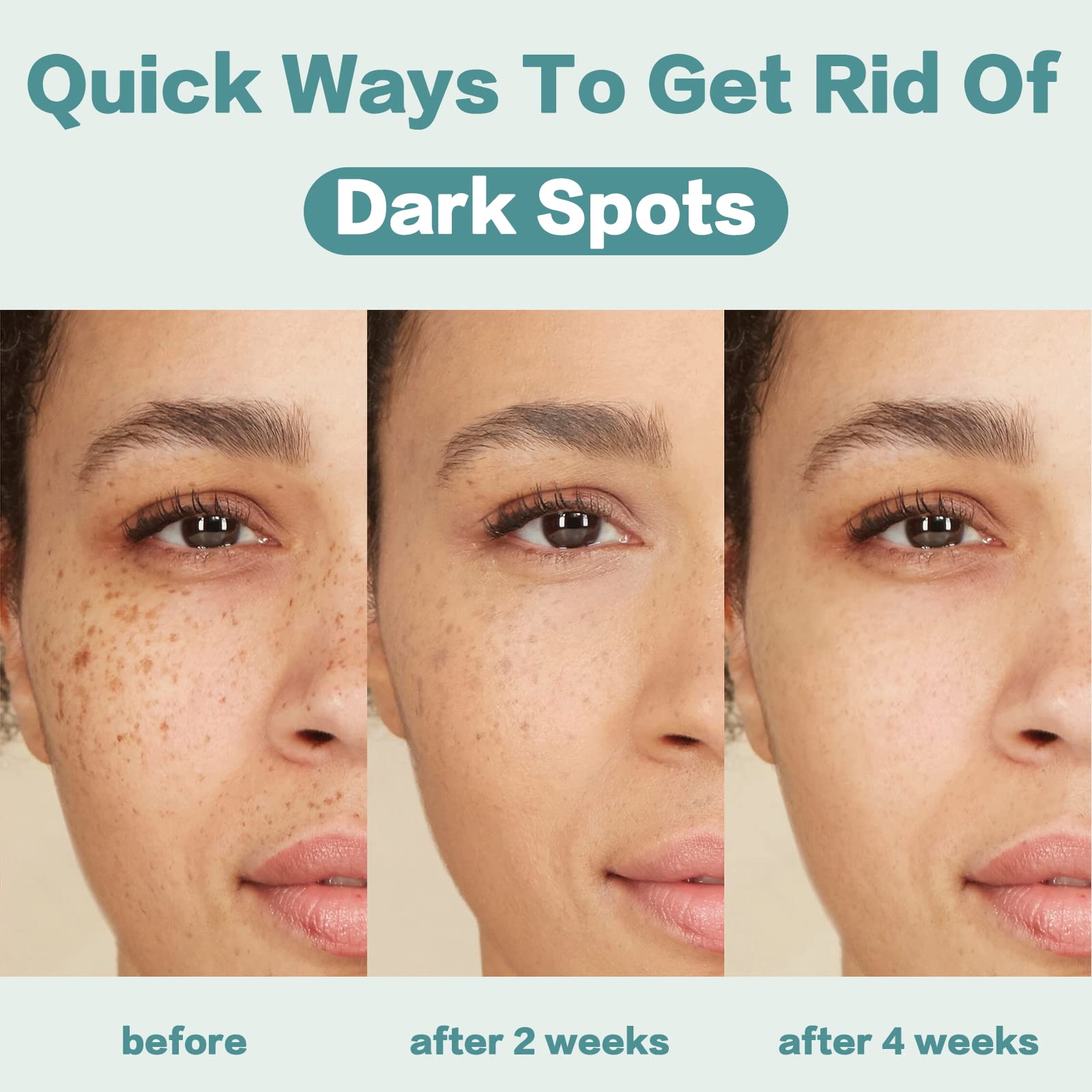 CITYGOO Dark Spot Remover – Application matin et soir pour un rituel efficace