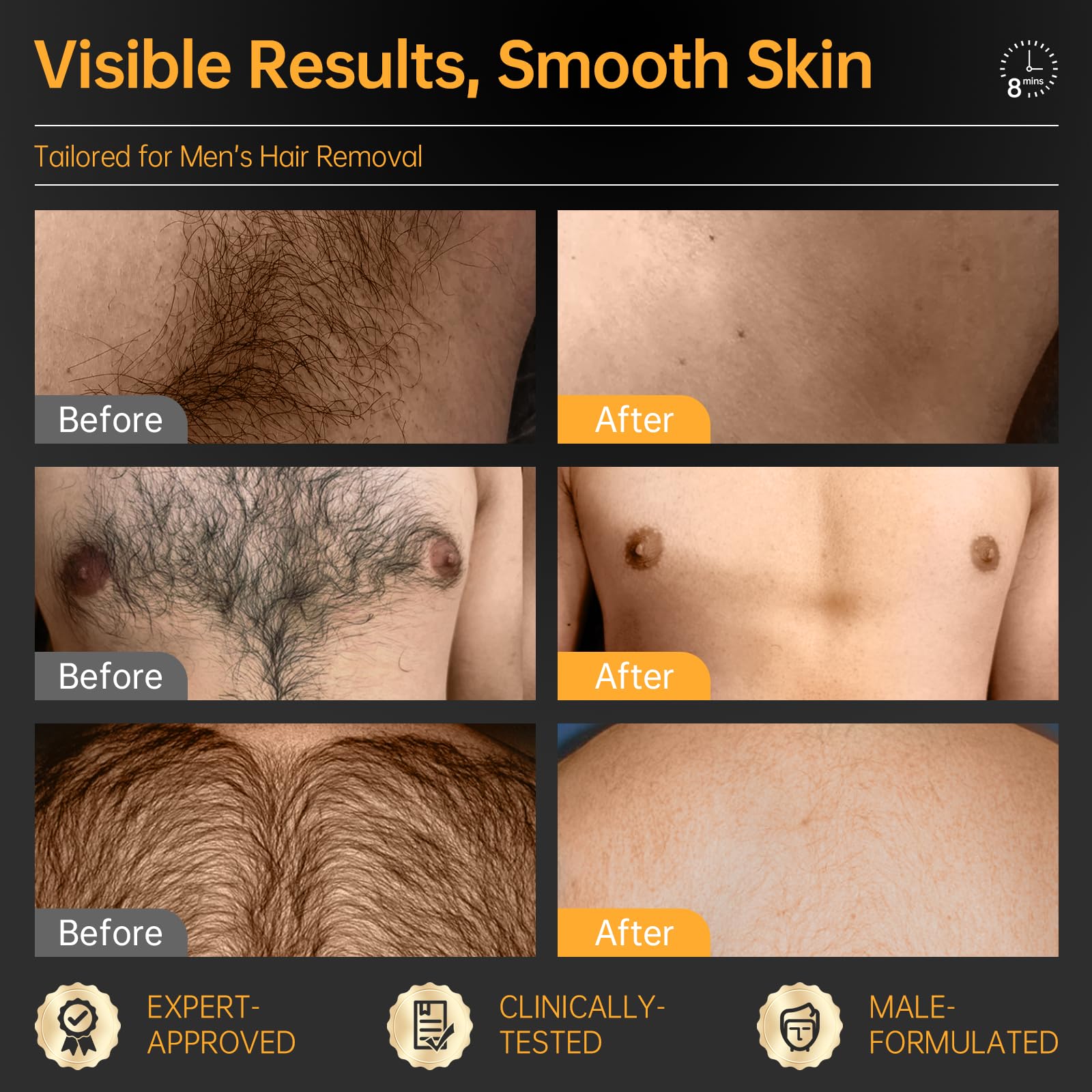 CKM Crème dépilatoire pour homme sur torse et dos, peau lisse après utilisation.