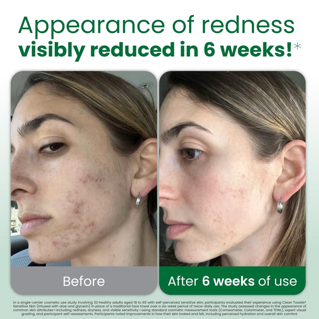 Clean Skin Club – serviettes-visage jetables infusées aloès et glycérine pour hydratation légère.