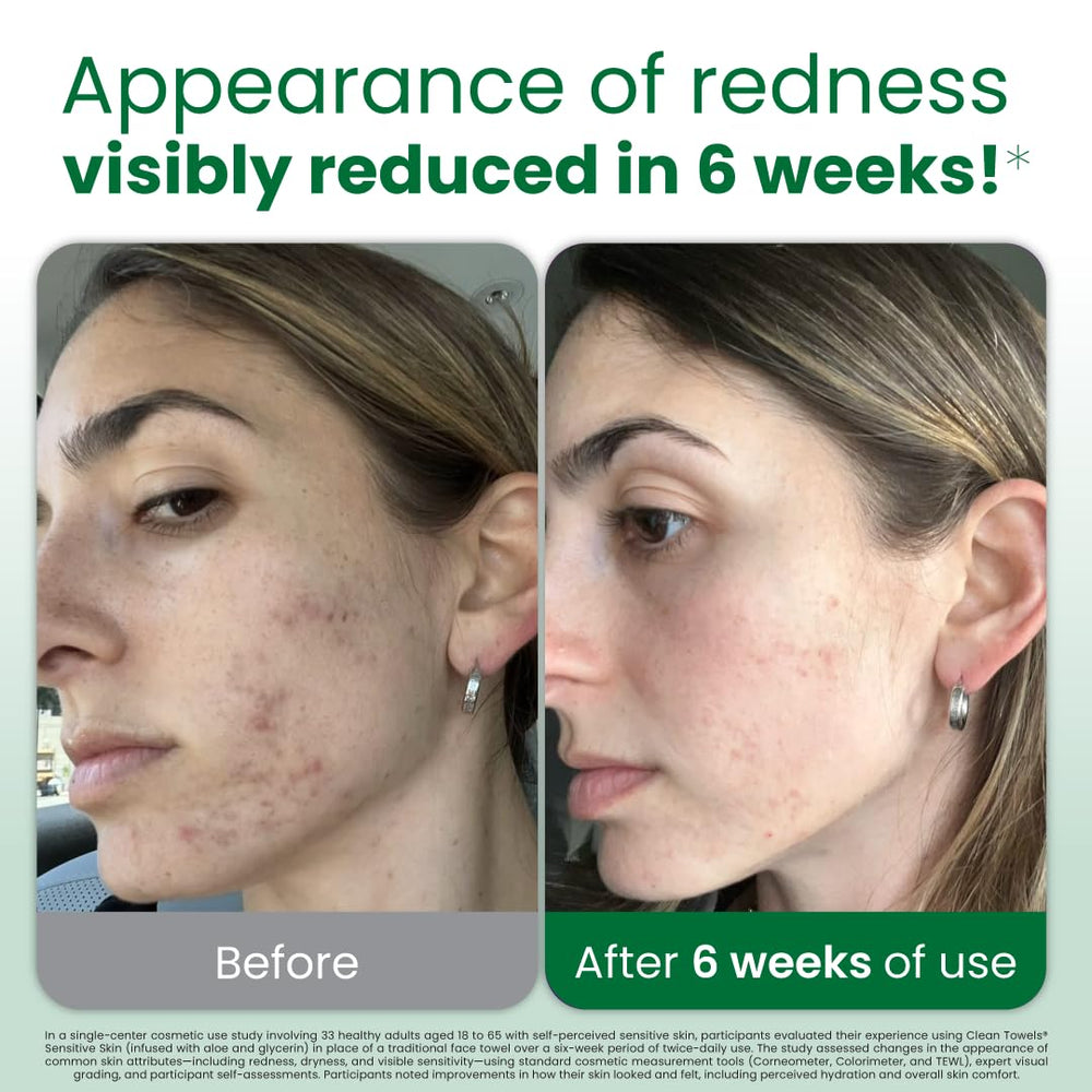 Clean Skin Club – serviettes-visage jetables infusées aloès et glycérine pour hydratation légère.