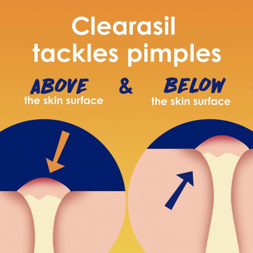 Lingettes exfoliantes Clearasil 5-en-1 éliminant résidus et sébum.