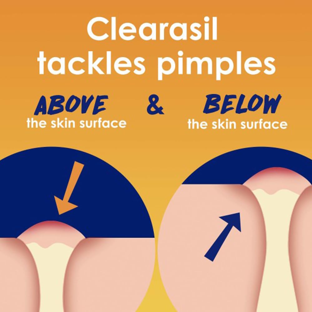 Clearasil aide à prévenir l’apparition de nouvelles marques d'acné.