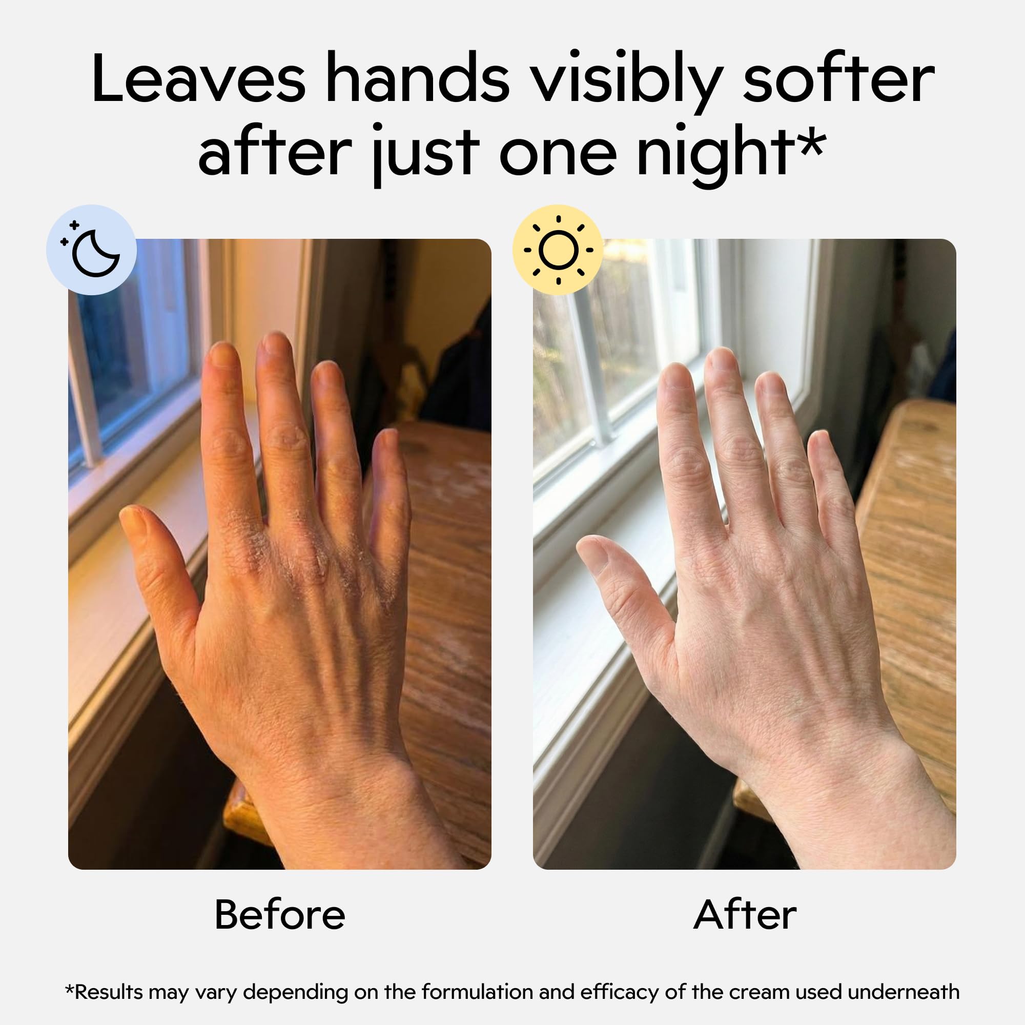 Gants Clearbody avec poignet élastique pour un ajustement sûr pendant le sommeil.