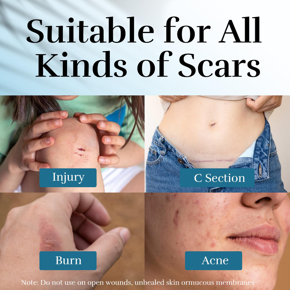 CLNABFR gel-scar-silicone-tube : application rapide et absorption sans résidu.
