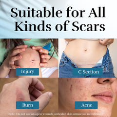 CLNABFR gel-scar-silicone-tube : application rapide et absorption sans résidu.