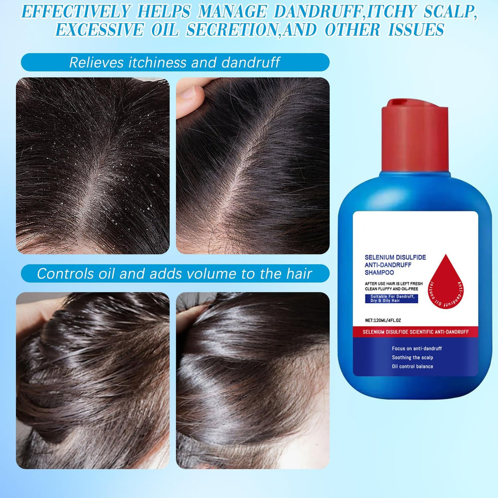 CLYXQP Shampoing nettoyage profond du cuir chevelu et des longueurs.