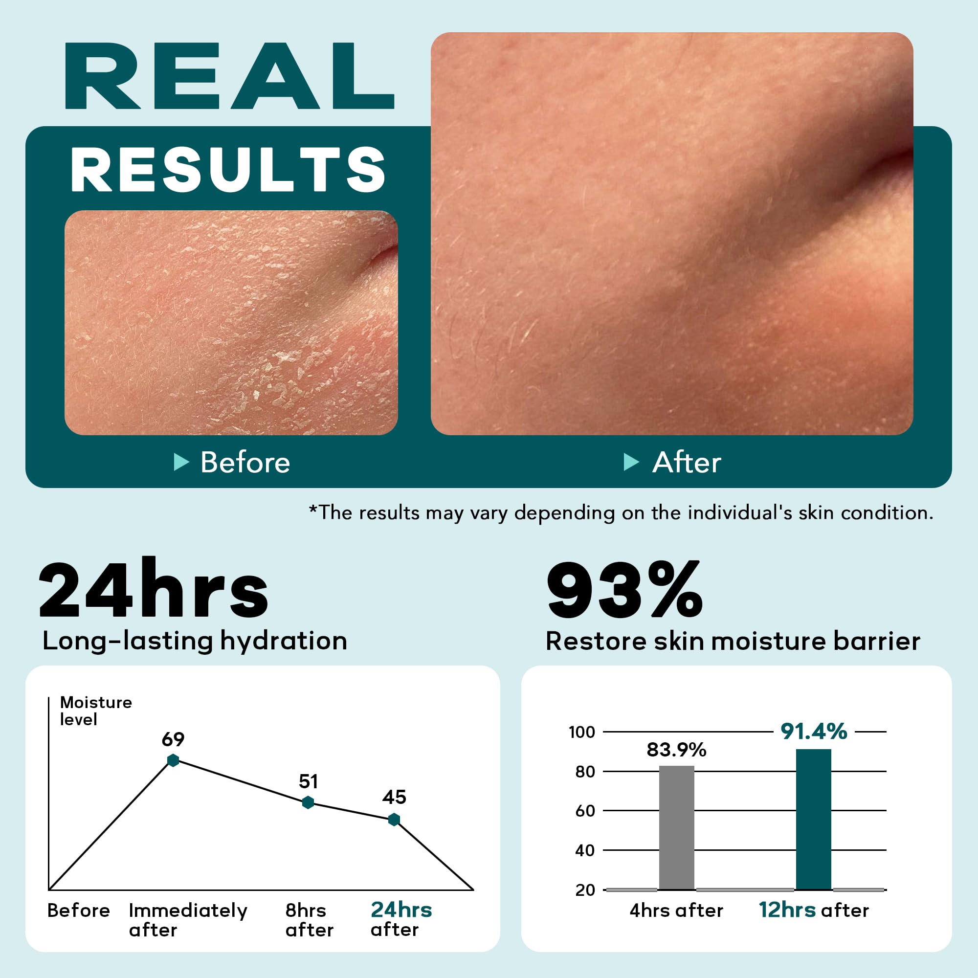 CMYYDX Crème visage 6-en-1 – utilisation jour et nuit pour plus de confort