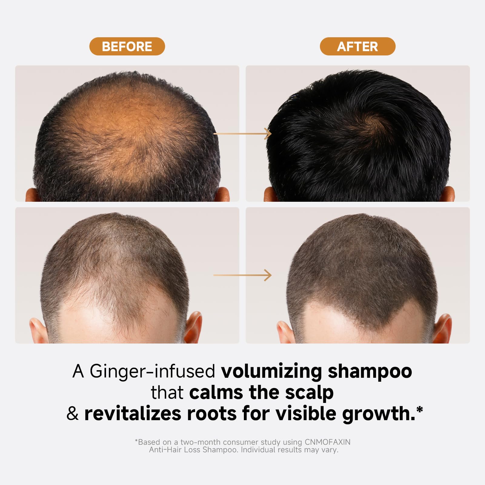 CNMOFAXIN Shampoing croissance capillaire — formulation enrichie pour densité et volume.