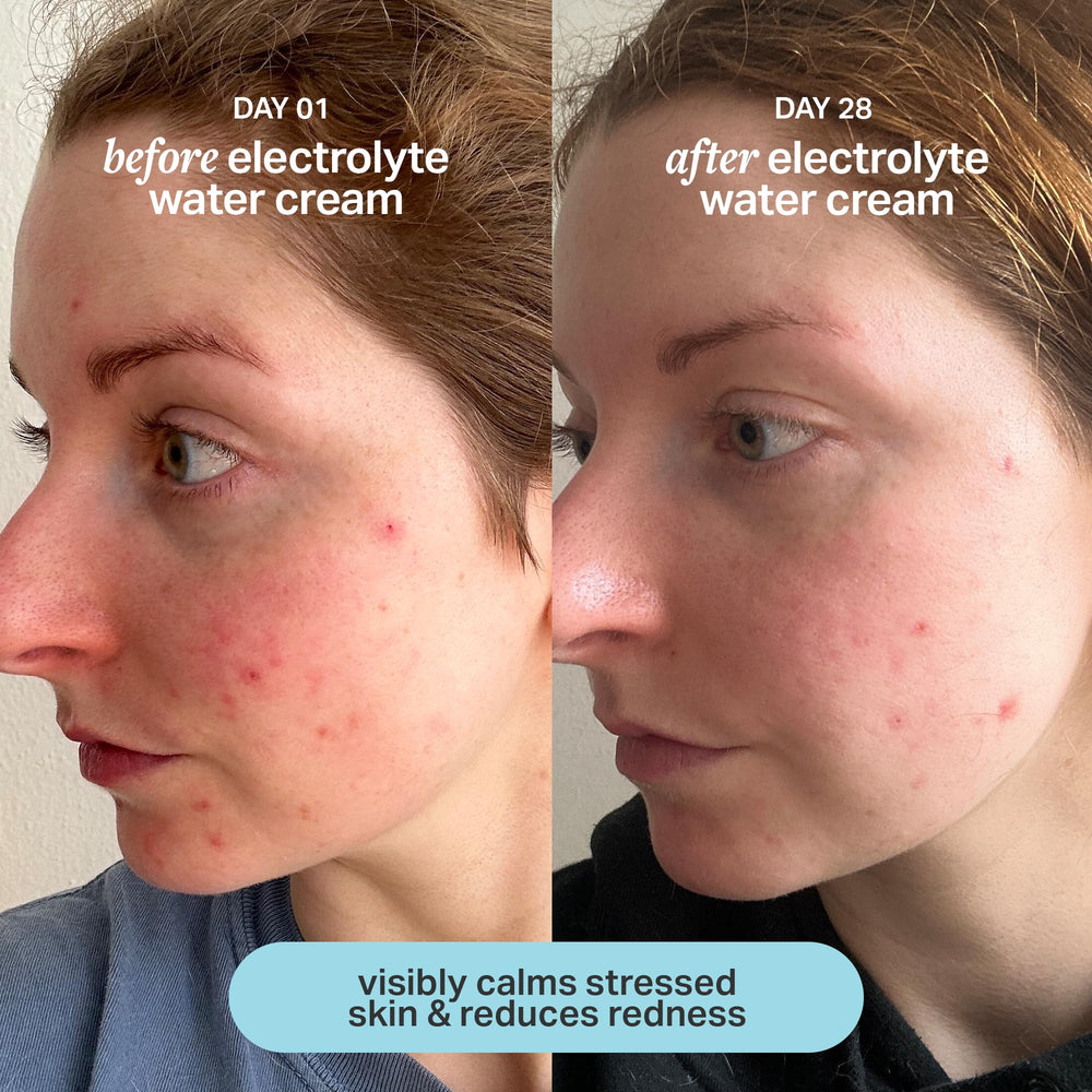 Face and neck massage with Cocokind Electrolyte Water Cream for balanced hydration.