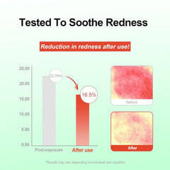 COMFORTENA Acide azélaïque 10% serum, texture légère sur la peau.
