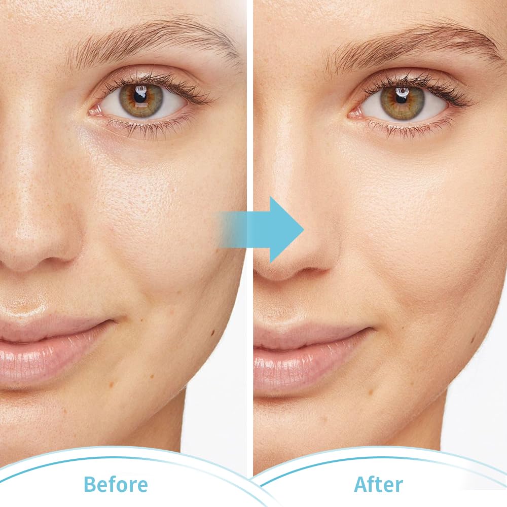 Utilisation post chirurgie ou tensions du visage avec CONBELLA