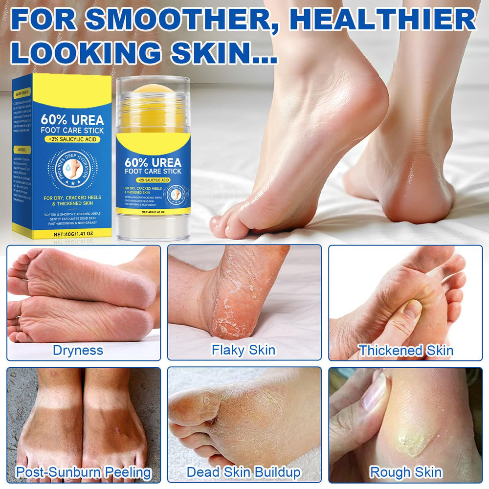 Texture du baume ConfidMiss sur la peau des pieds.