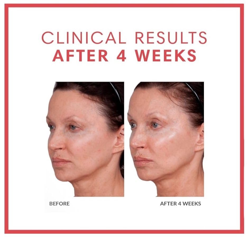 Consult Beaute Volumagen acide hyaluronique et vitamine C pour nourrir