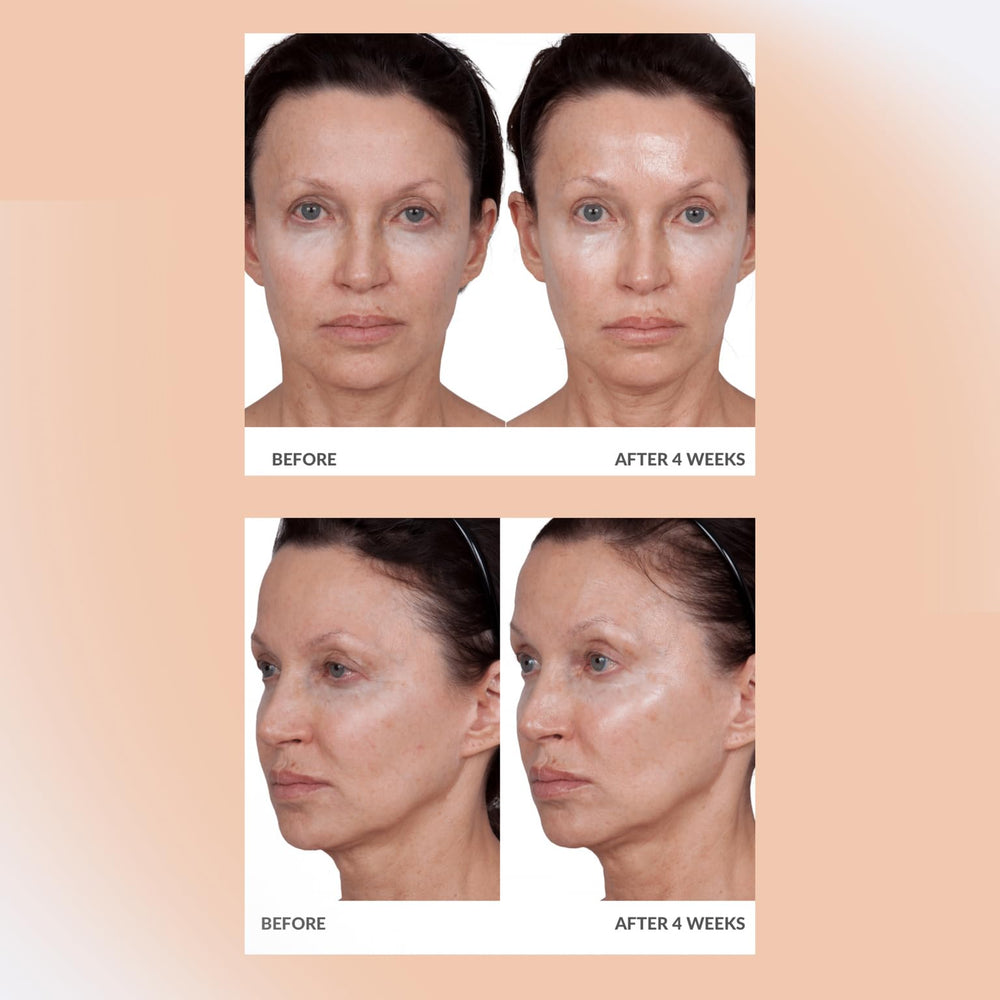 Application douce de la crème Volumagen sur la peau pour un effet repulpant.