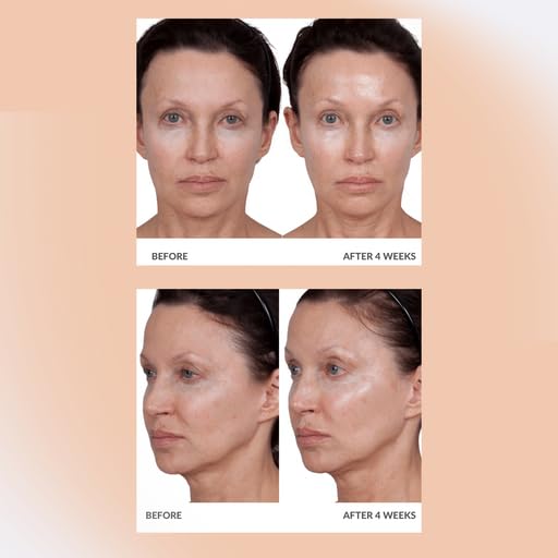 Consult Beaute Volumagen test cutané recommandé avant utilisation