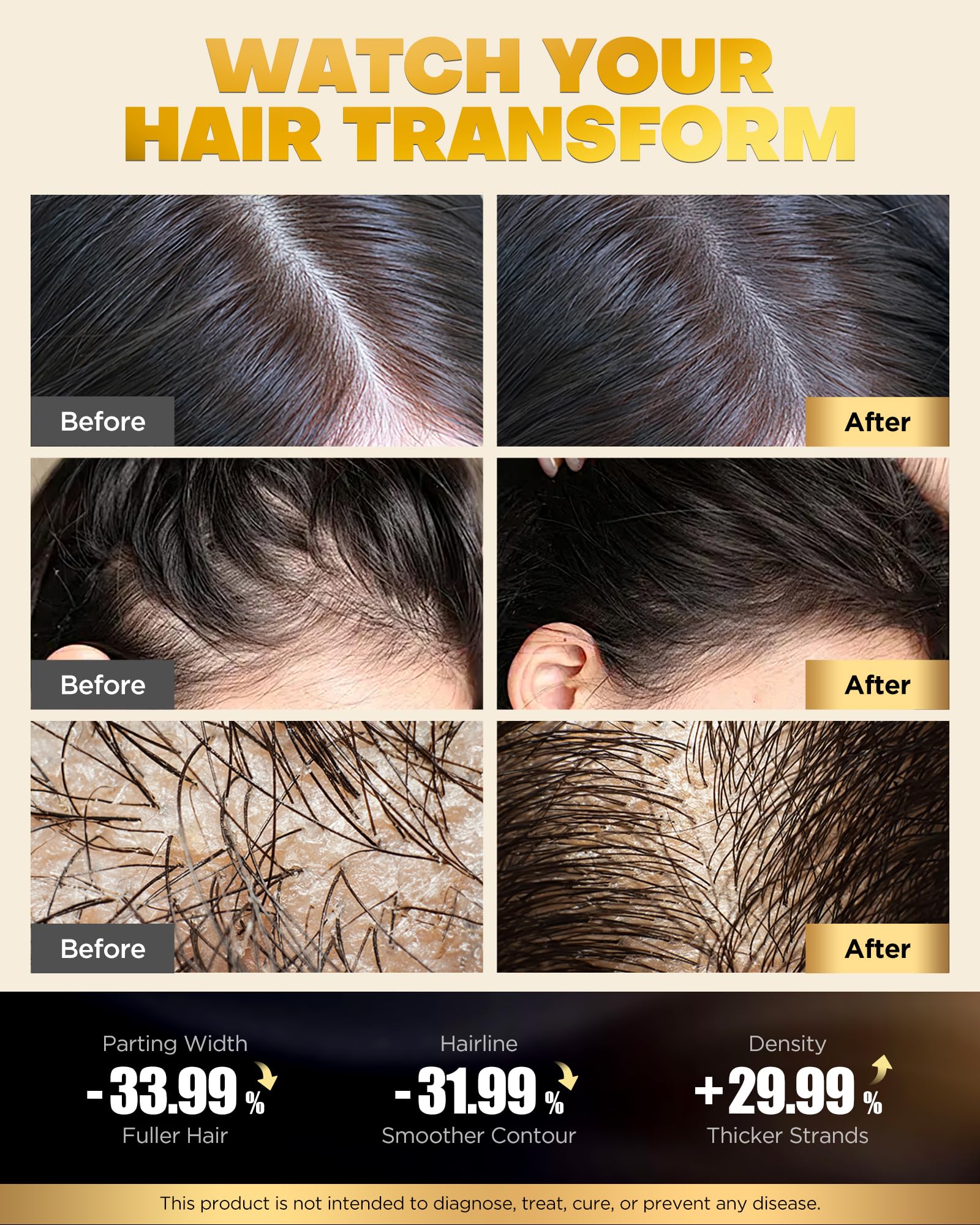COOLKESI Shampooing en mousse; nettoyage doux et revitalisant des cheveux.