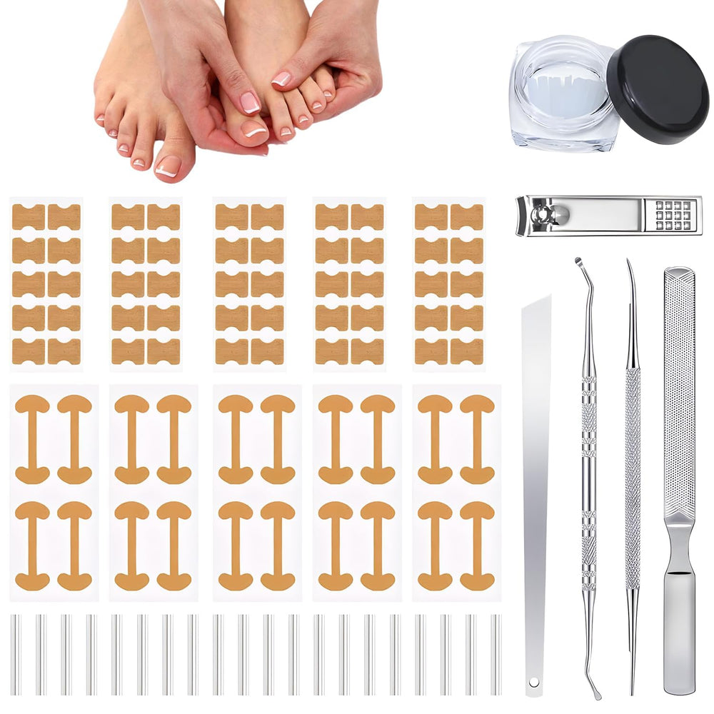 Correcteur d’ongle incarné – ensemble-outils : confort durable à domicile.