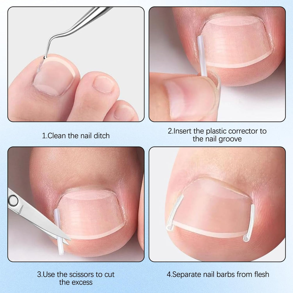 Correcteur d’ongle incarné – outils-debutants : outils simples pour débuter l’entretien des ongles.