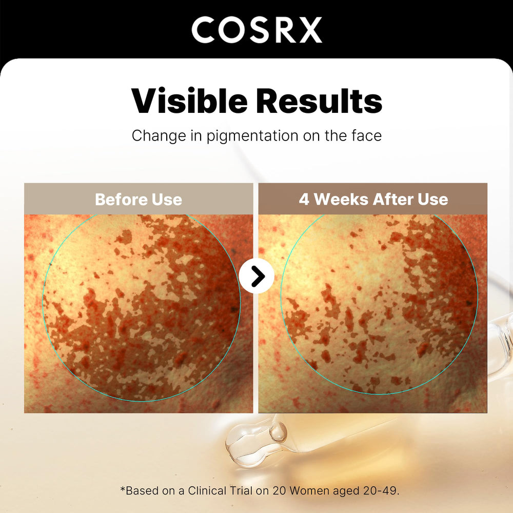 COSRX niacinamide texture lisse et peau plus douce après application