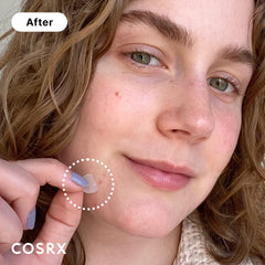 Pansement hydrocolloïde COSRX absorbant rapidement l'excès sur la peau.