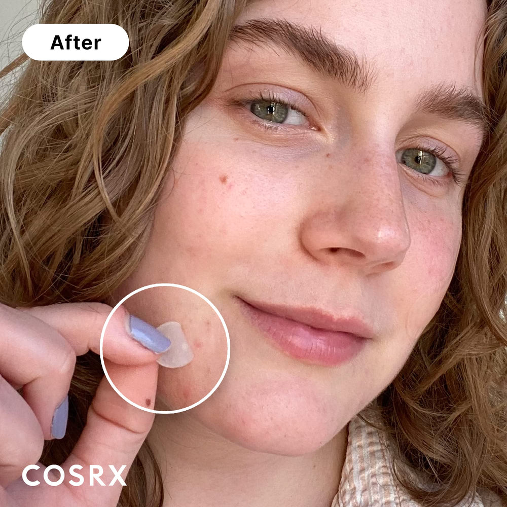 COSRX patch hydrocolloïde absorbant pour boutons, absorption ciblée et discrète.