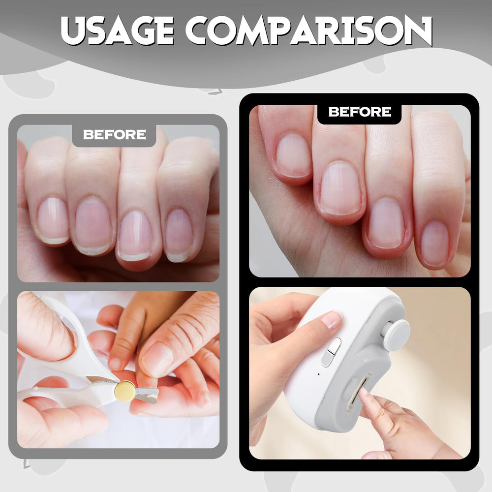 Coupe-ongles électrique 3-en-1, capteur poussière et rangement intégré
