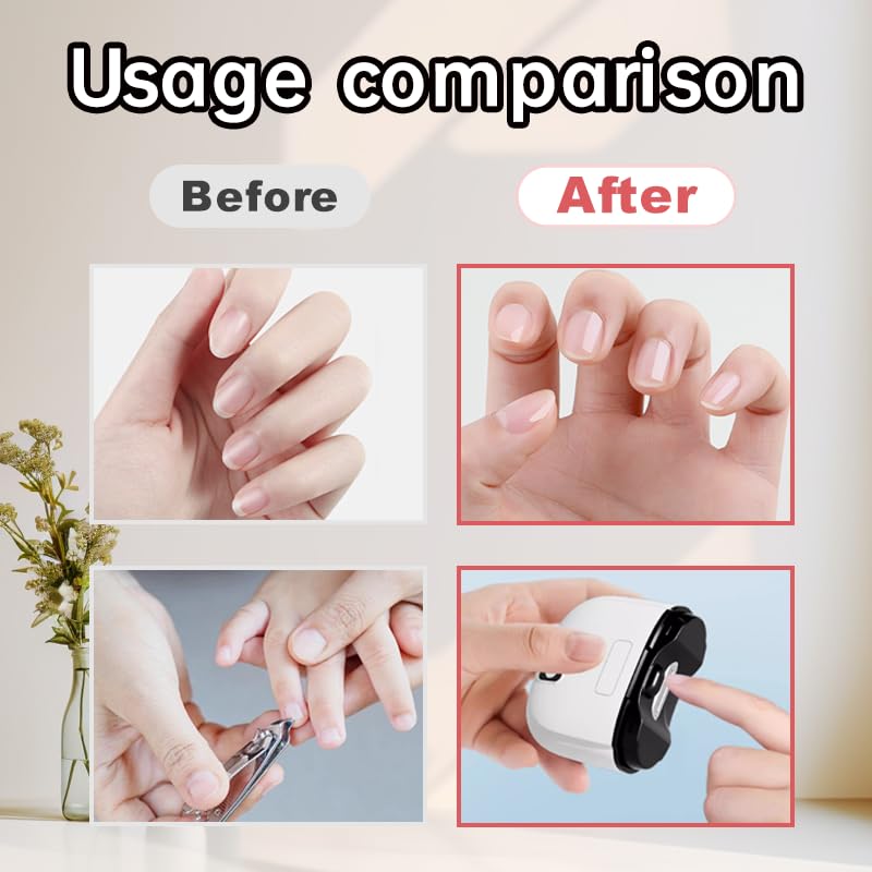 Coute-ongles électrique avec sécurité protégeant la peau lors de la coupe.