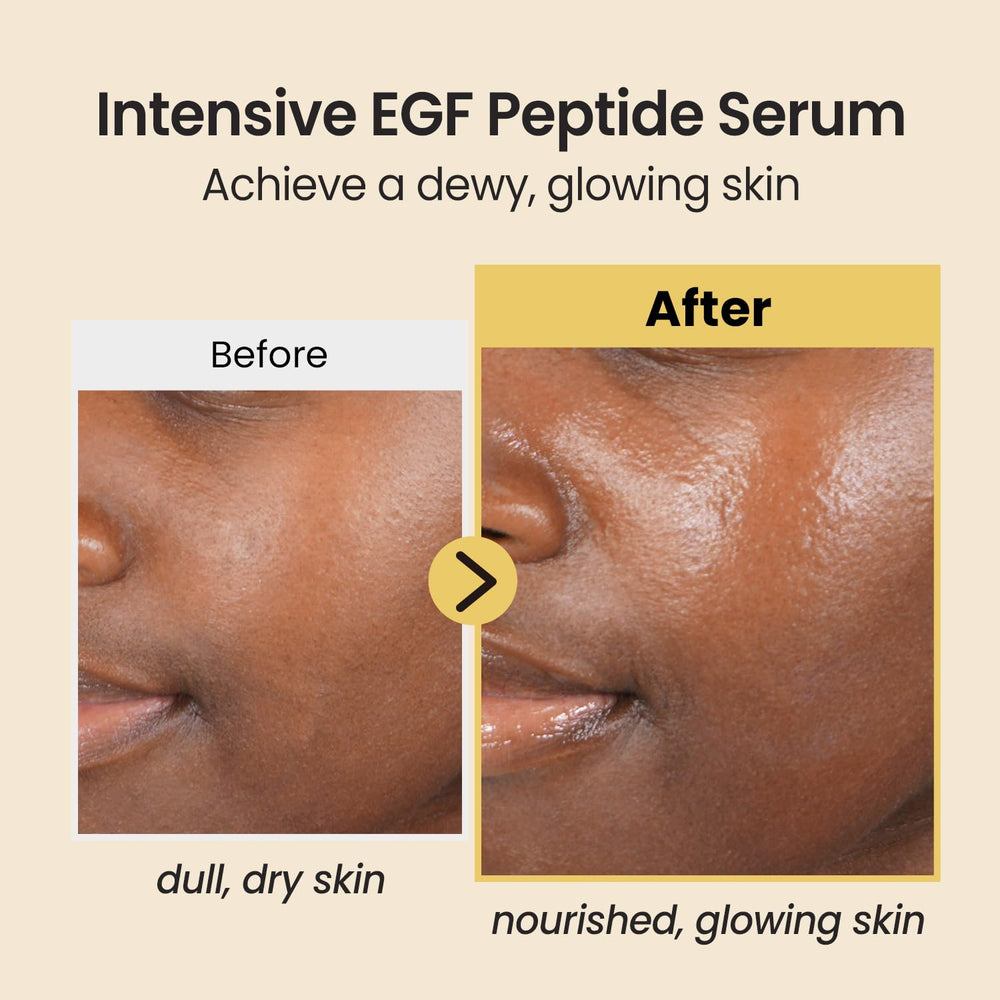 coxir serum egf peptides pompe: dosage précis et pratique au quotidien.
