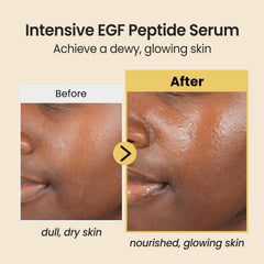 coxir serum egf peptides pompe: dosage précis et pratique au quotidien.