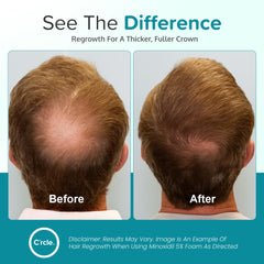 C'rcle Minoxidil 5% application ciblée sur cuir chevelu et stimulation.