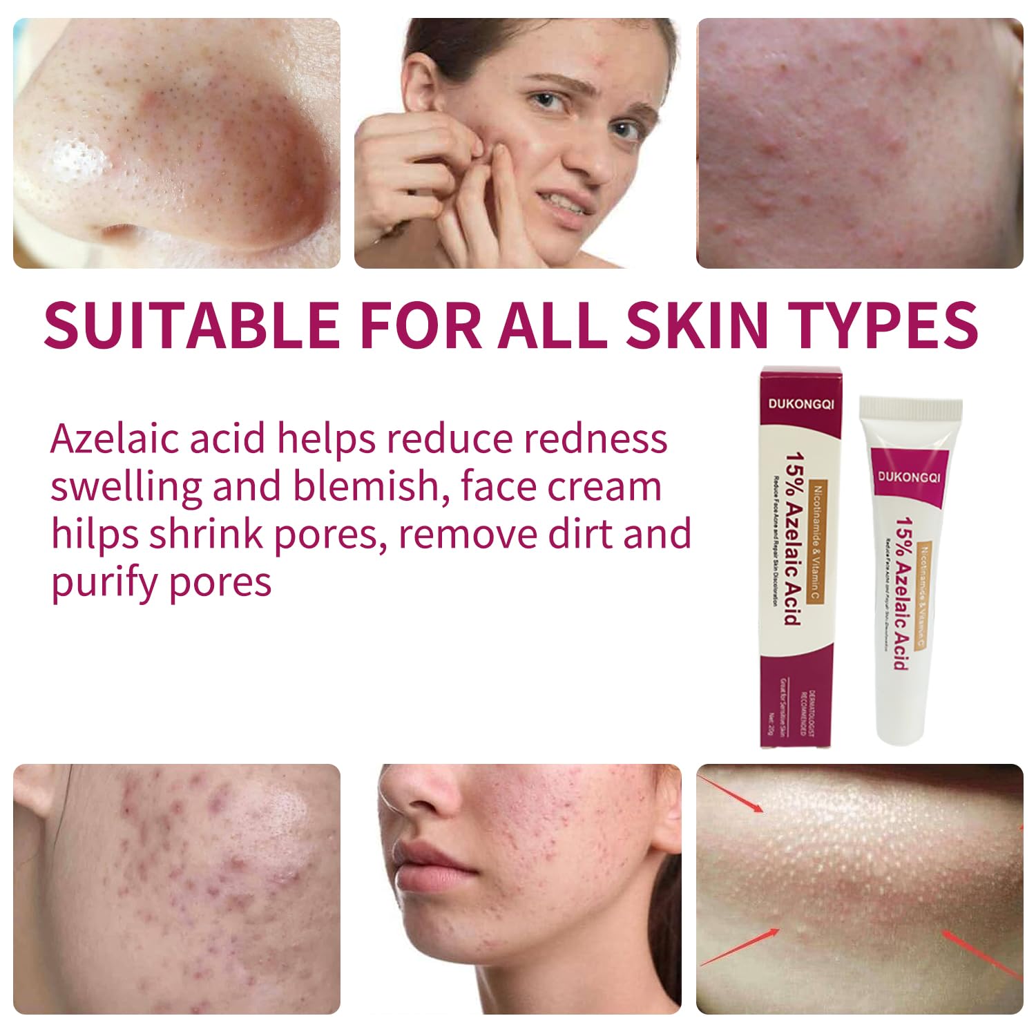 Crème acide azélaïque visage, emballage élégant