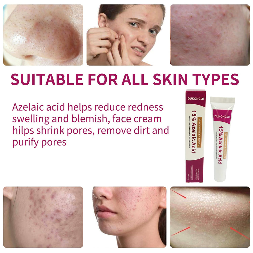 Crème acide azélaïque visage, emballage élégant