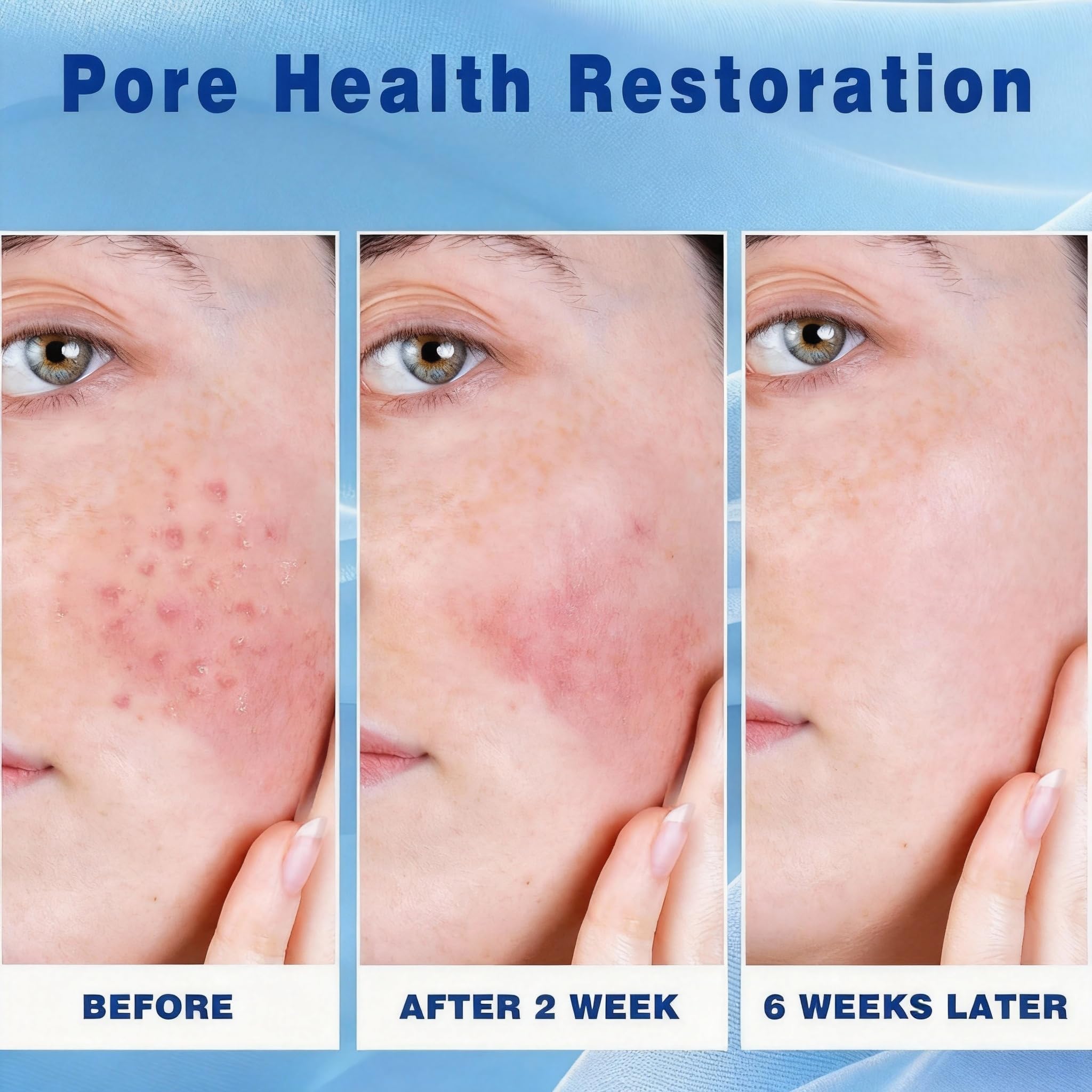 Crème Acide Azelaïque: texture légère et pénétration rapide avec hyaluronique