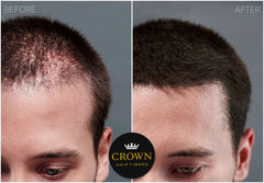 CROWN TWENTY1 fibres capillaires 28g – adhérence durable face au vent et à la pluie