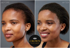 CROWN TWENTY1 fibres capillaires 28g – concealer naturel à base de kératine