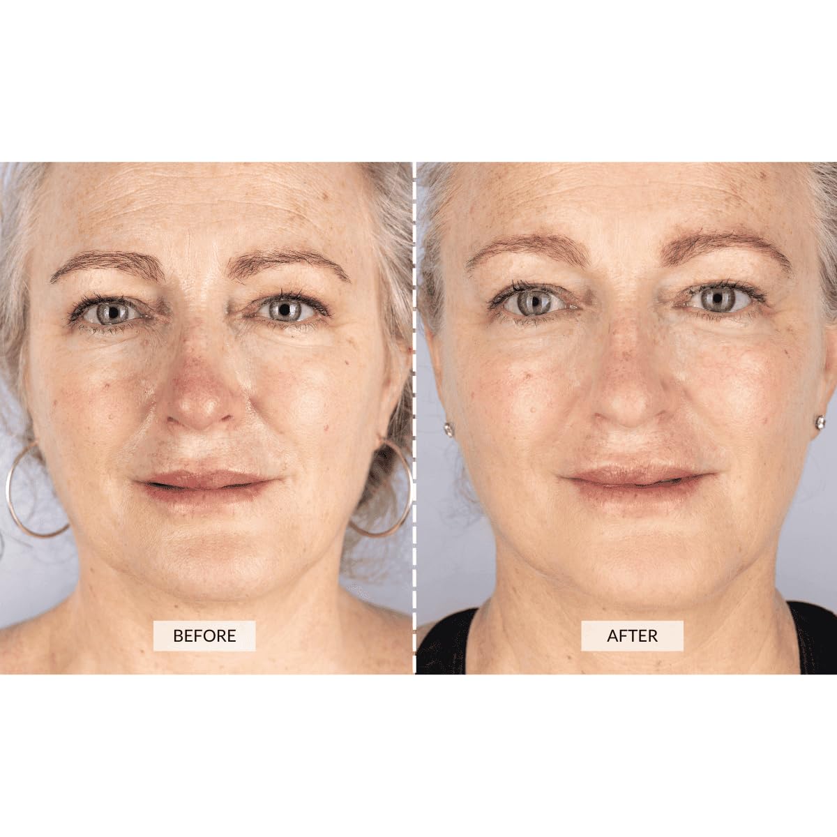 CurrentBody Masque LED: 132 diodes rouge et infrarouge pour une thérapie ciblée.