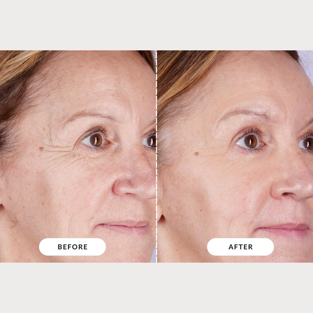 CurrentBody Masque LED visage Série 2 – couverture lumineuse améliorée