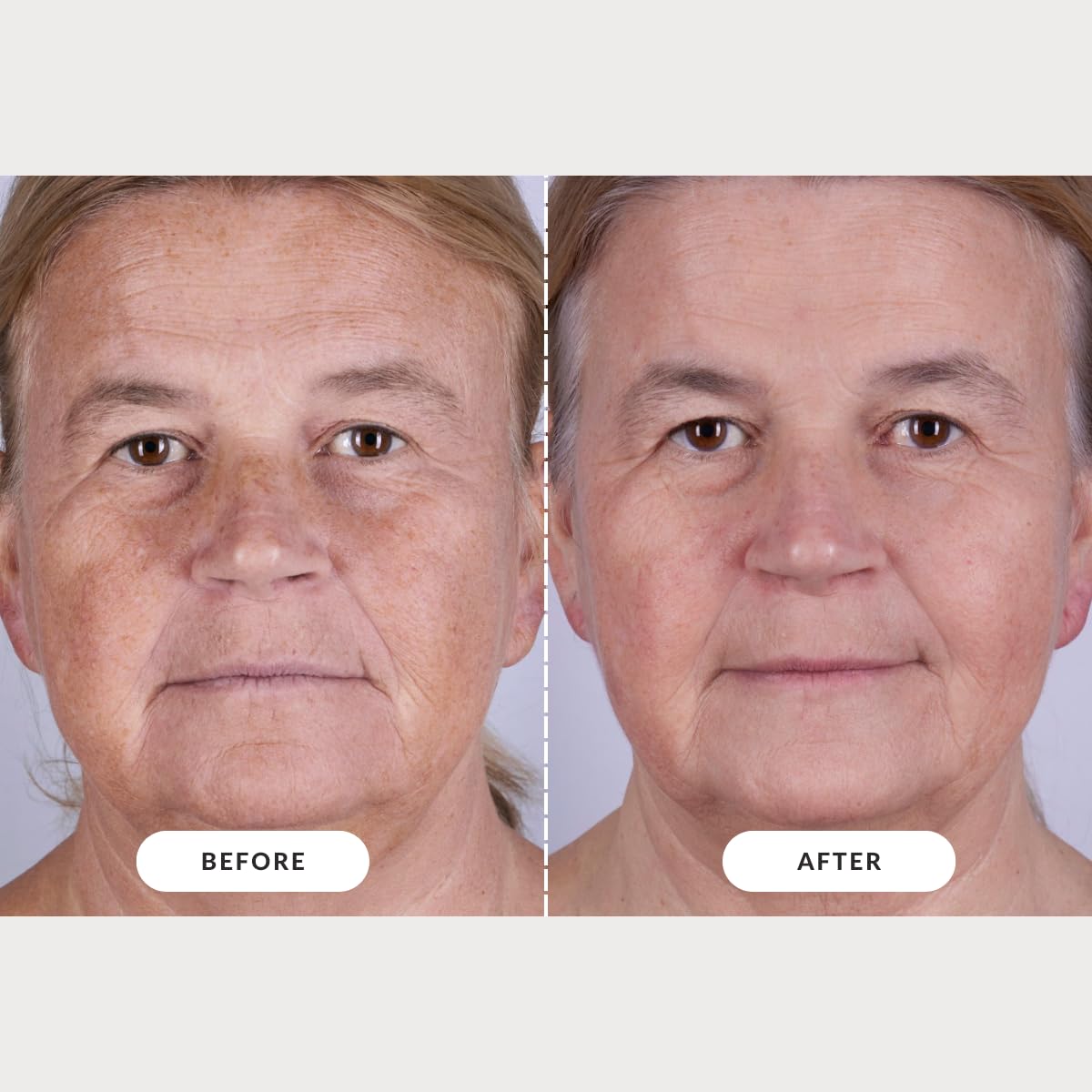 CurrentBody Masque LED visage Série 2 – fiche NFC et informations résultats