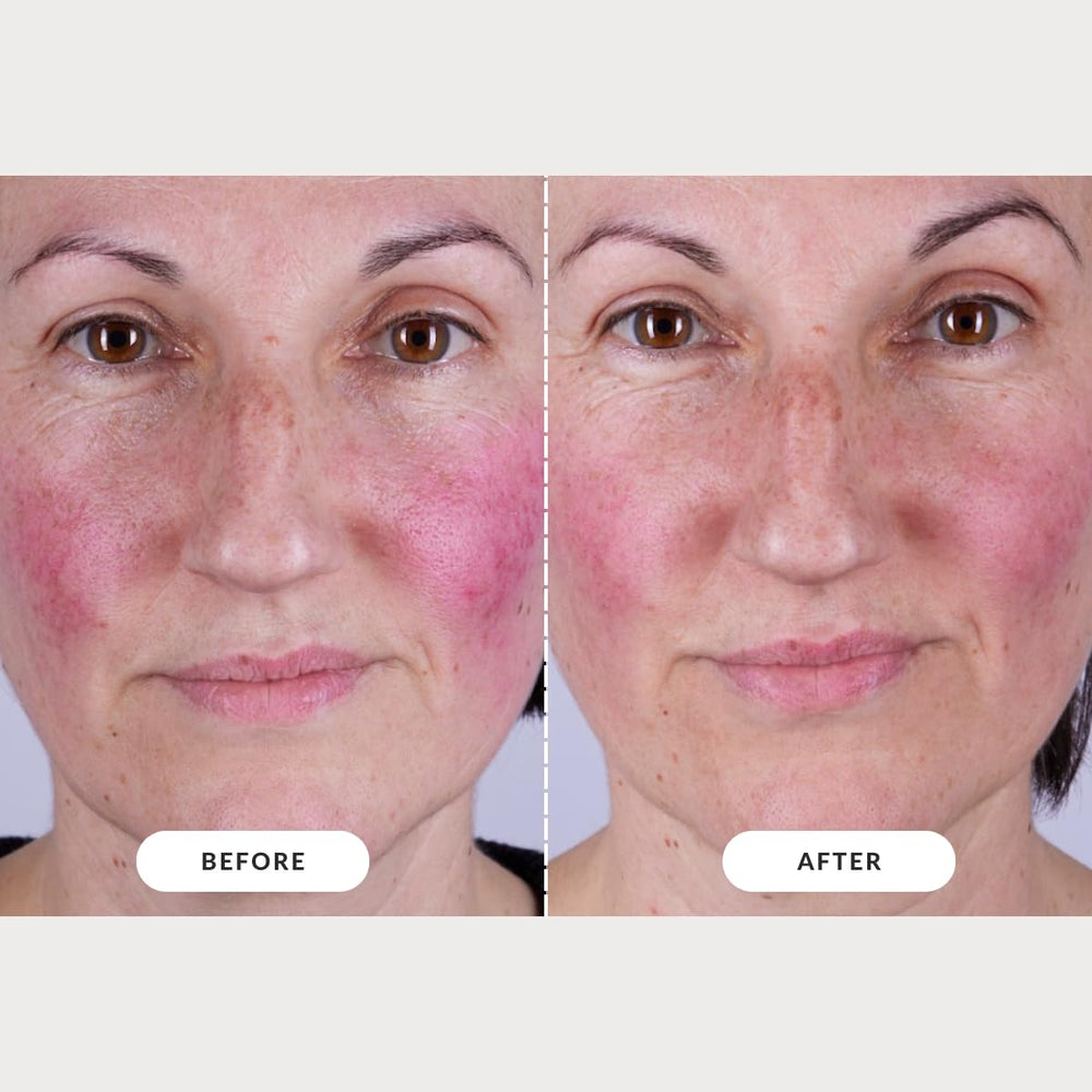 CurrentBody Masque LED visage Série 2 – usage quotidien et confort