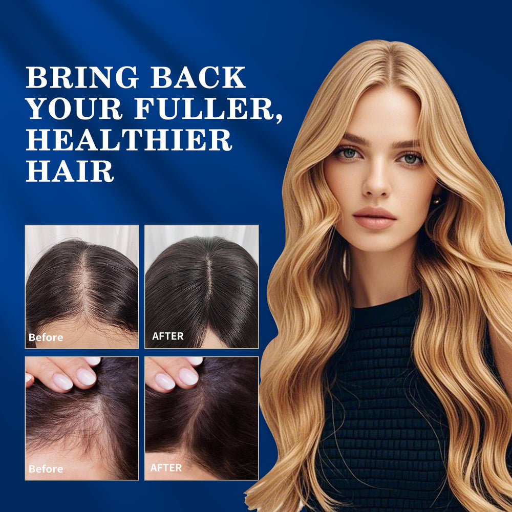 DAAZZS Minoxidil 5% avec biotine et niacinamide pour le renforcement des repousses.