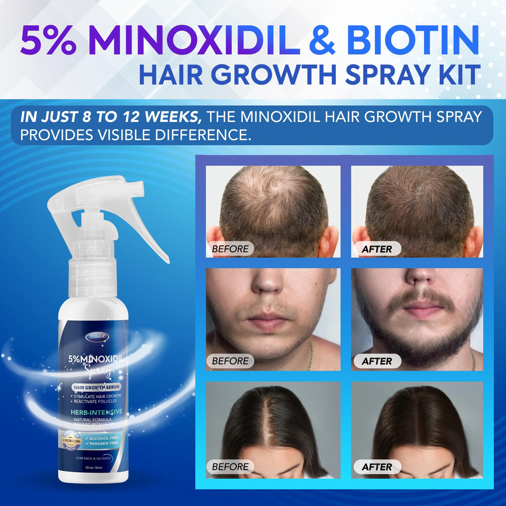 Dabida Minoxidil Spray, démonstration d'application précise sur le cuir chevelu.