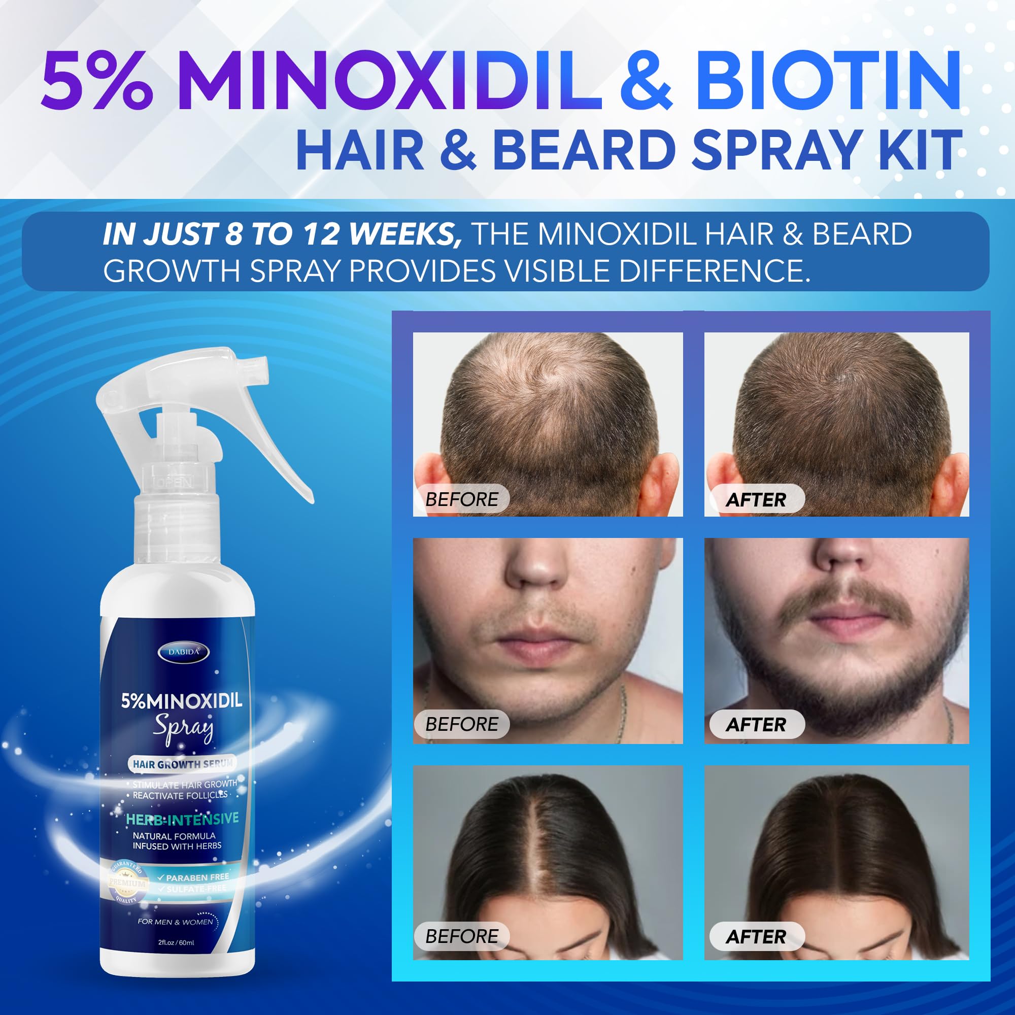 Vaporisateur DABIDA Minoxidil facilitant l'application quotidienne.